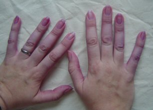 Purple fingers